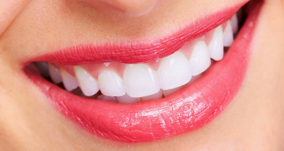 Best Teeth Lightening Products - The Cody Experiment